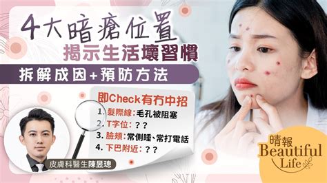 人中生瘡|暗瘡位置16個揭這些身體隱疾？中醫拆解4大暗瘡成因…